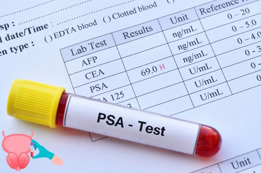 How Can One Determine if their PSA Levels are High Due to a Cause Other than Prostate Cancer?